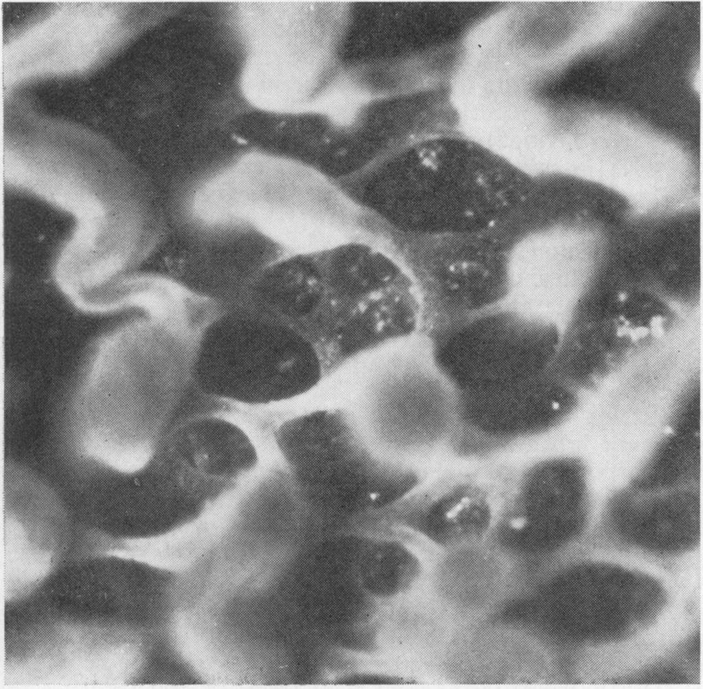 FIG. 5. 10 C. A. Loehry and B. Creamer FIG. 5. Autolysedjejunal mucosa.
