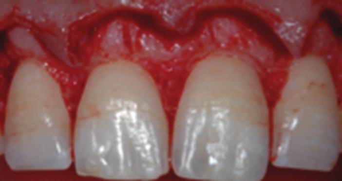 during developmental events such as palate and skin differentiation, eye opening, and tooth eruption [5].