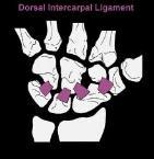 Wrist Ligaments Wrist Ligaments Dorsal radiocarpal ligament Resists flexion/dorsal glide of carpals on the radius Dorsal Intercarpal ligaments