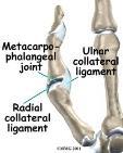 CMC Joint 1 st Metacarpophalangeal Joint Synovial Modified ovoid Condyloid Compound