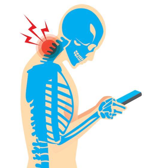 ihunch or Text Neck MSD related to looking down at tablets, cell phones and other wireless devices for too long Strain on neck muscles