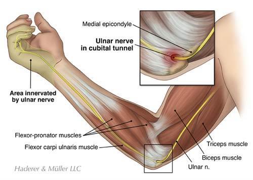 Cellphone Elbow/Cubital Tunnel Syndrome - Anatomy Ulnar nerve starts at the side of the neck, where the nerve roots exit the spine through small openings between the vertebra called foramen.