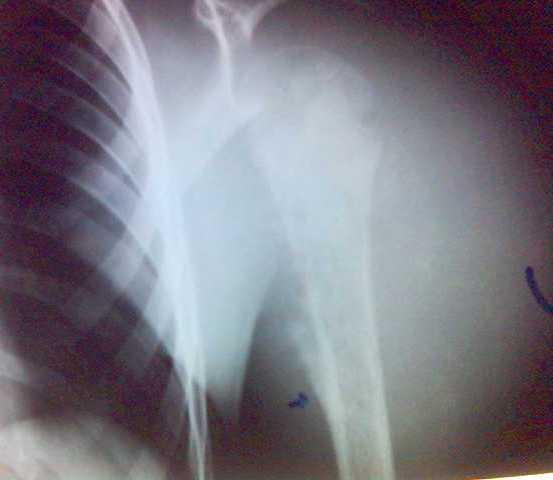 Figure 9: Plain X-ray