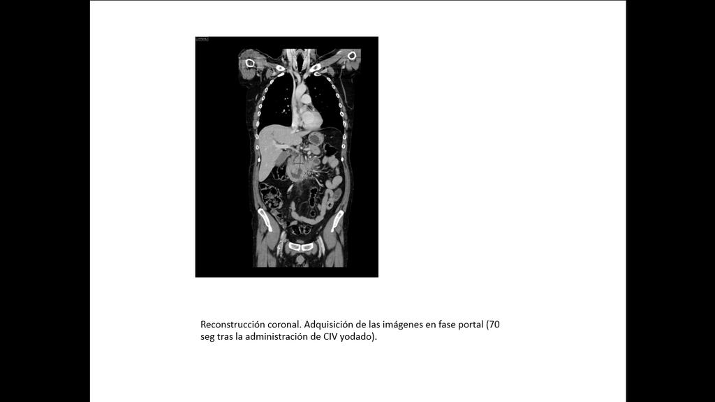 Fig. 1. CT images. A.