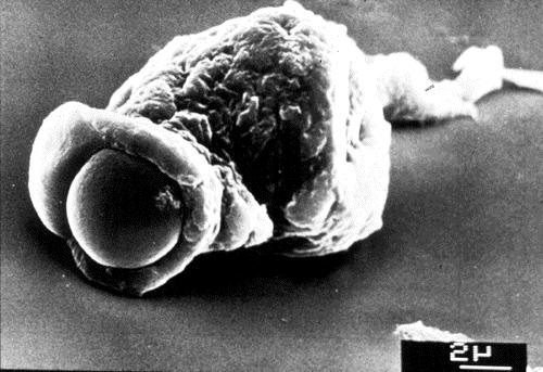 Micrograph of a trophozoite ingesting