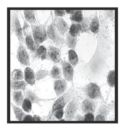 U poređenju sa kontrolama, procenat podeljenih ćelija kod ćelija tretiranih AE-om bio je značajno manji (95% kod netretiranih ćelija u odnosu na 15% kod tretiranih ćelija).