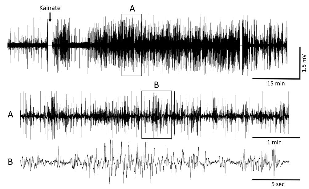 Figure 4. Recording of P7 rat pup before (A) and after (B, C) administration of 0.1 mg/kg KA.