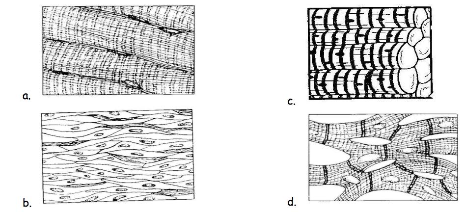 Match the following muscle and nervous tissue types with the image(s) representing them: 33.