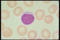 Description: Normal small lymphocyte.