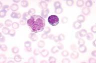 Description: Monocyte and small lymphocyte.