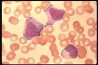 Description: Typical Monocyte.