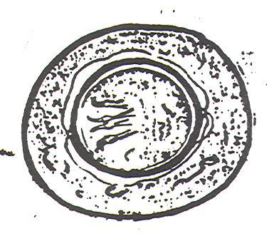 Worm: Hymenolepis nana (dwarf tapeworm of