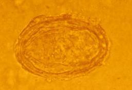 Worm: Schistosoma japonicum (blood fluke) General Family: Trematode Ovum Larvae or Adult Life Cycle: Location: Far East, Africa, S.