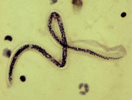 Worm: Wuchereria bancrofti General Family: Nematode Ovum Larvae or Adult Image source: http://www.dpd.cdc.gov/dpdx/html/filariasis.