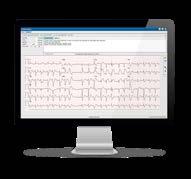 CARDIAC STRESS TESTING HOLTER TELEMEDICINE ELI 380 ECG ELI 280 ECG Q-Stress or X-Scribe HScribe Holter Web Upload Cardiac