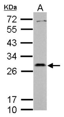 What information about the mutation will a western blot provide? Assume you have a variety of antibodies.