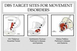 Movement Disorders Specialist Noran Neurological Clinic 1 2 Objectives To