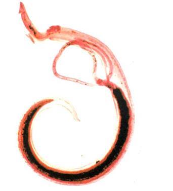 DEFINITION Schistosomiasis is one of the most important parasitic diseases