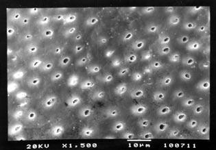 In vitro evaluation of the effect of natural orange juices on dentin morphology onds and washed with a stream of tap water for seconds. For SEM analysis (Jeol T0 A, Jeol Ltd.