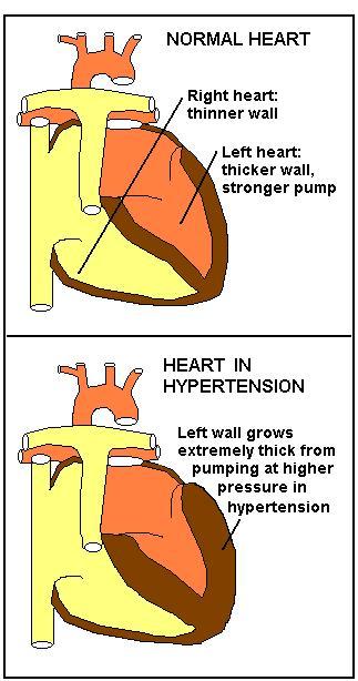 What Does Blood Pressure Do to Body?