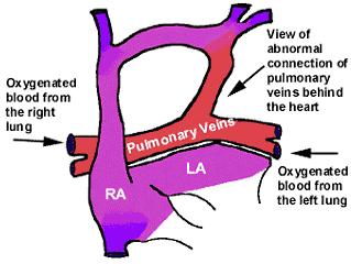Instead they are connected to one of the veins from the main circulation so that the blood returning from the lungs