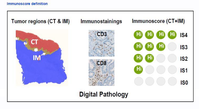 Evaluating immune cell spatial context within tumor Immunoscore : quantify the density of CD3+ T-cells and CD8+ cytotoxic T- cells within the tumor core and invasive margin A strong lymphocytic