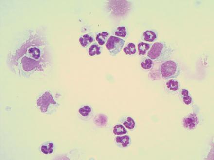 neutrophils.