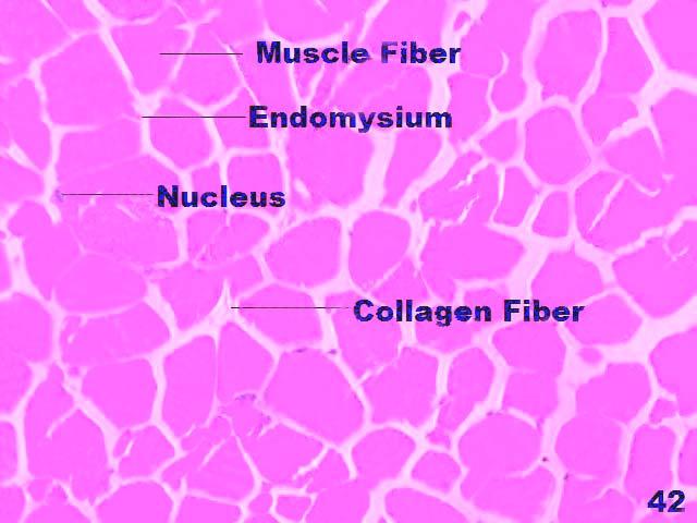 01) differed among the muscles between the Cobb-500 and Ross strain (Table 1). Highest perimysial thickness (79.52±7.