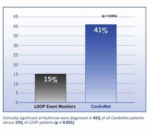 Landmark Clinical Study for MCOT The Diagnosis of Cardiac Arrhythmias: A Prospective, Multi-Center, Randomized Study Comparing Mobile Cardiac Outpatient