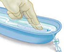 Control Posterior Epistaxis Thoroughly soak in sterile water