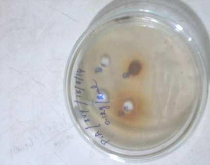 positive and gram negative bacterial strain. The extract of carmellia sinensis exhibited greater extend of antibacterial activities.