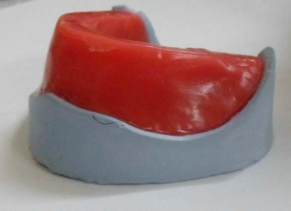 Poly (methyl methacrylate) resin has been widely used as a denture base material due to its desirable properties of excellent aesthetic, low water sorption and solubility, relative lack of toxicity,