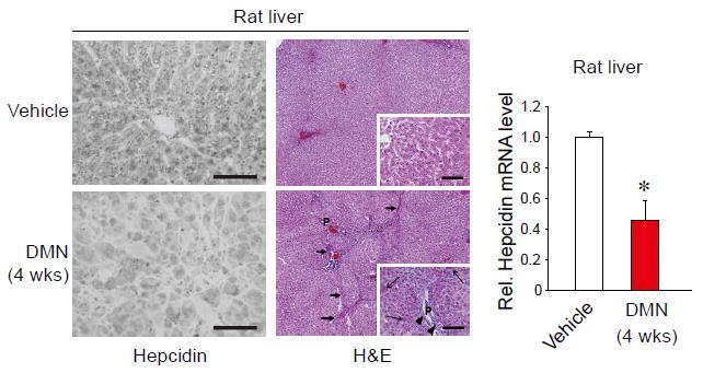 Supplementary Figure 1. Repression of hepcidin expression in the liver of mice treated with DMN Immunohistochemistry for hepcidin and H&E staining (left).