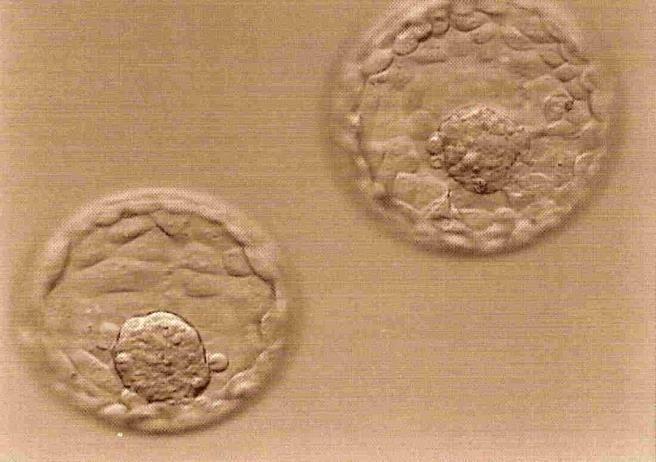 Embryo Selection for Transfer Morphological Grading Embryos can be graded on their appearance.