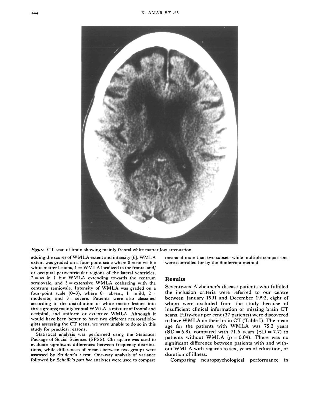 444. K. AMAR ET AL. Figure. CT scan of brain showing mainly frontal white matter low attenuation. adding the scores of WMLA extent and intensity [6].