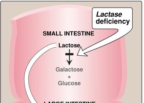 Abnormal Lactose Metabolism More than