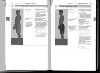 Hyperlordotic and Kypholordotic Kypholordotic Posture : forward C-spine: