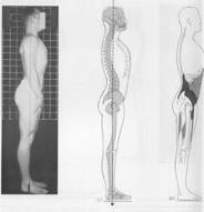 slightly posterior L spine: hyperextended lordosis : anterior tilt Knees: slightly