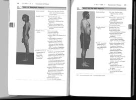 T spine: flexion L spine: flexion, flattening : posterior tilt Hips: hyperextended