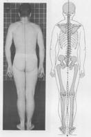 joints Figure A; posture appears good from the posterior view