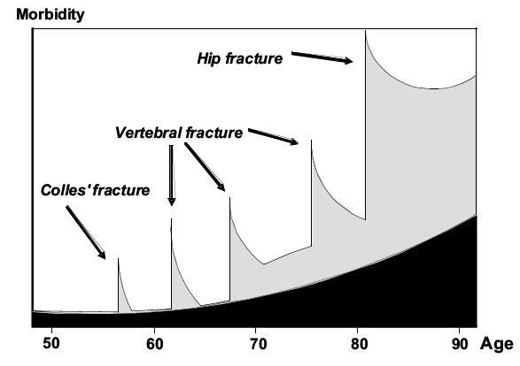 Fracture and Disability