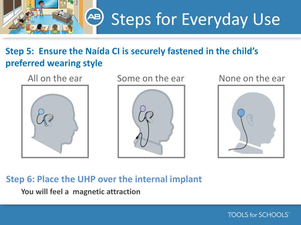 Speaker s Notes: Attach the processor to the child in the preferred wearing configuration All on the ear,
