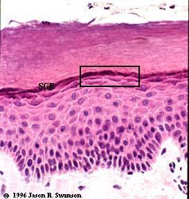 Layer of Epidermis Stratum granulosum help to form a waterproof barrier that functions to prevent