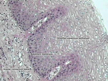 Stratified Squamous Epithelium Stratified = several layers; Squamous = shape of cells are flat Cells fit together to form sheets Has an apical