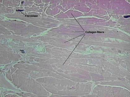 Dense Irregular Connective Tissue Has a blood supply Collagen and elastic fibers located