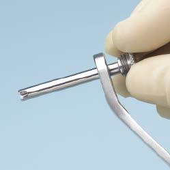 Fixation Using Schanz Screws 6 Make small stab incision Prepare for Schanz screw insertion by making