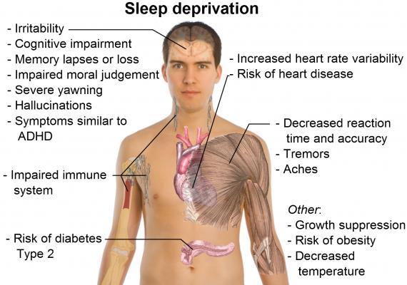 ADAM.org Consequences of poor sleep in college students Dec.