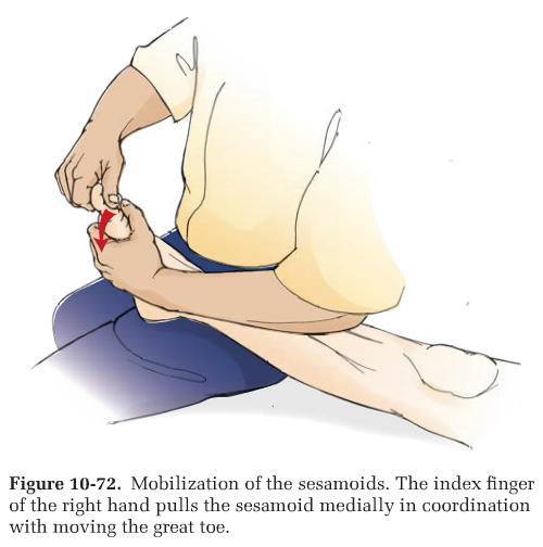 iii. Mobilize sesamoids - facing cauda, patient's foot on your thigh 1. flex great toe to slack (use your lateral hand) 2.