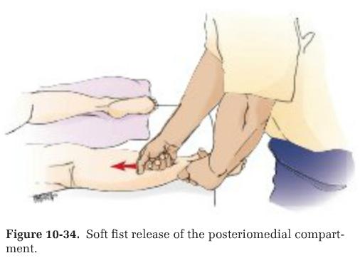1 st stroke: side lying w/bottom leg straight, top leg bent