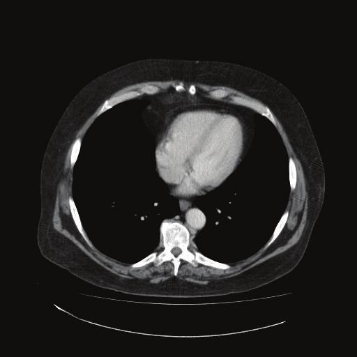 illustrated CT of the thorax with resolution of the